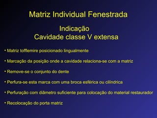 Matriz Individual Fenestrada
Indicação
Cavidade classe V extensa
• Matriz tofflemire posicionado lingualmente
• Marcação da posição onde a cavidade relaciona-se com a matriz
• Remove-se o conjunto do dente
• Perfura-se esta marca com uma broca esférica ou cilíndrica
• Perfuração com diâmetro suficiente para colocação do material restaurador
• Recolocação do porta matriz
 