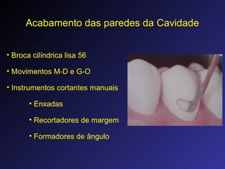 Acabamento das paredes da Cavidade
• Broca cilíndrica lisa 56
• Movimentos M-D e G-O
• Instrumentos cortantes manuais
• Enxadas
• Recortadores de margem
• Formadores de ângulo
 