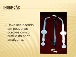 INSERÇÃO



   Deve ser inserido
    em pequenas
    porções com o
    auxílio do porta
    amálgama.
 