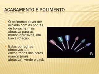 ACABAMENTO E POLIMENTO

   O polimento dever ser
    iniciado com as pontas
    de borracha mais
    abrasiva para as
    menos abrasivas, em
    baixa rotação.

   Estas borrachas
    abrasivas são
    encontrados nas cores
    marron (mais
    abrasiva), verde e azul;
 