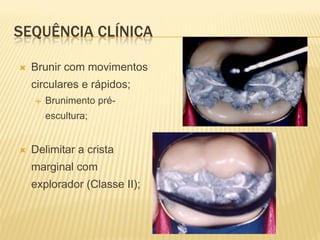 SEQUÊNCIA CLÍNICA

   Brunir com movimentos
    circulares e rápidos;
       Brunimento pré-
        escultura;


   Delimitar a crista
    marginal com
    explorador (Classe II);
 