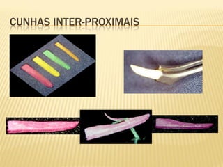 CUNHAS INTER-PROXIMAIS
 