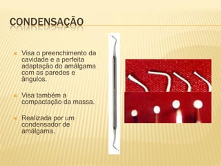 CONDENSAÇÃO

   Visa o preenchimento da
    cavidade e a perfeita
    adaptação do amálgama
    com as paredes e
    ângulos.

   Visa também a
    compactação da massa.

   Realizada por um
    condensador de
    amálgama.
 