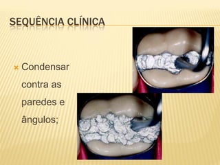 SEQUÊNCIA CLÍNICA



   Condensar
    contra as
    paredes e
    ângulos;
 