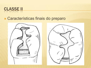 CLASSE II

   Características finais do preparo
 