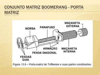 CONJUNTO MATRIZ BOOMERANG - PORTA
MATRIZ
 