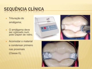SEQUÊNCIA CLÍNICA
   Trituração do
    amálgama;

   O amálgama deve
    ser colocado num
    pote Dapen de vidro;

   Acomodar o material
    e condensar primeiro
    nas proximais
    (Classe II);
 
