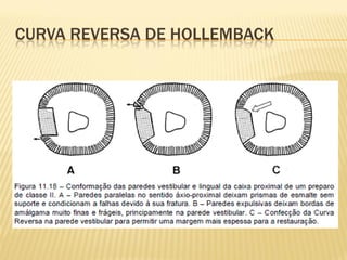 CURVA REVERSA DE HOLLEMBACK
 