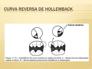 CURVA REVERSA DE HOLLEMBACK
 