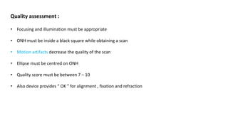 Quality assessment :
• Focusing and illumination must be appropriate
• ONH must be inside a black square while obtaining a scan
• Motion artifacts decrease the quality of the scan
• Ellipse must be centred on ONH
• Quality score must be between 7 – 10
• Also device provides “ OK ” for alignment , fixation and refraction
 