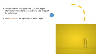 • Total 64 sections each done with 1/16 mm. depth
interval are obtained and used to create a 3D image of
the optic nerve
• Total 64 sections are equivalent to 4mm. Depth
 