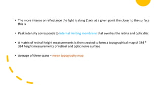 • The more intense or reflectance the light is along Z axis at a given point the closer to the surface
this is
• Peak intensity corresponds to internal limiting membrane that overlies the retina and optic disc
• A matrix of retinal height measurements is then created to form a topographical map of 384 *
384 height measurements of retinal and optic nerve surface
• Average of three scans – mean topography map
 