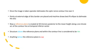 • Once the image is taken operator delineates the optic nerve contour line over it
• Points at external edge of disc border are placed and machine draws best fit ellipse to delineate
the disc
• Now a reference plane is created at 50 microns posterior to the mean height along a six minute
arc of the contour line at temporal inferior sector
• Structure above the reference plane and within the contour line is considered to be rim
• Anything below the reference plane is cup
 