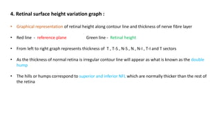 4. Retinal surface height variation graph :
• Graphical representation of retinal height along contour line and thickness of nerve fibre layer
• Red line - reference plane Green line - Retinal height
• From left to right graph represents thickness of T , T-S , N-S , N , N-I , T-I and T sectors
• As the thickness of normal retina is irregular contour line will appear as what is known as the double
hump
• The hills or humps correspond to superior and inferior NFL which are normally thicker than the rest of
the retina
 