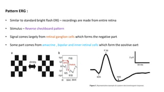 Pattern ERG :
• Similar to standard bright flash ERG – recordings are made from entire retina
• Stimulus – Reverse checkboard pattern
• Signal comes largely from retinal ganglion cells which forms the negative part
• Some part comes from amacrine , bipolar and inner retinal cells which form the positive part
 