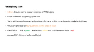 Peripapillary scan :
• 3.4mm. Circular scan to measure thickness of RNFL is done
• Curve is obtained by opening up the scan
• Starts with temporal quadrant and continues clockwise in right eye and counter clockwise in left eye
• Values are provided for four quadrants and for 12 clock hours
• Classified as WNL – green , Borderline - yellow and outside normal limits. - red
• Average RNFL thickness is also established
 