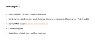 In the report :
• It includes RNFL thickness curves for both eyes
• It is drawn as a black line on a graph featuring thickness in microns of different areas ( T , S ,N and I )
• Normal RNFL curve has double hump appearance
• Color coding done
• Divided into 12 clock hours and four quadrants
 