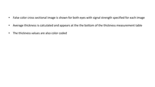 • False color cross sectional image is shown for both eyes with signal strength specified for each image
• Average thickness is calculated and appears at the the bottom of the thickness measurement table
• The thickness values are also color coded
 