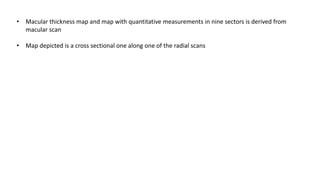 • Macular thickness map and map with quantitative measurements in nine sectors is derived from
macular scan
• Map depicted is a cross sectional one along one of the radial scans
 