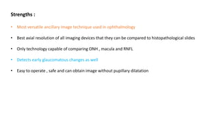 Strengths :
• Most versatile ancillary image technique used in ophthalmology
• Best axial resolution of all imaging devices that they can be compared to histopathological slides
• Only technology capable of comparing ONH , macula and RNFL
• Detects early glaucomatous changes as well
• Easy to operate , safe and can obtain image without pupillary dilatation
 