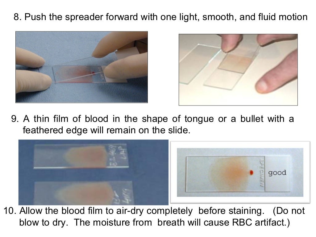 Prepration and staining of blood film