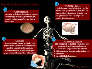 Lesiones Raras Prepresentacion fracturas............... | PPTX
