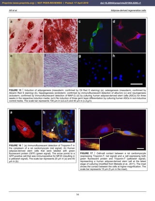 Alt et al. Adipose-derived regenerative cells
14
FIGURE 15  Induction of adipogenesis (mesoderm; confirmed by Oil Red O staining) (a), osteogenesis (mesoderm; confirmed by
Alizarin Red S staining) (b), hepatogenesis (endoderm; confirmed by immunofluorescent detection of albumin) (c) and neurogenesis
(ectoderm; confirmed by immunofluorescent detection of MAP-2) (d) by culturing human adipose-derived stem cells (ASCs) for three
weeks in the respective induction media. (e-h) No induction of three germ layer differentiation by culturing human ASCs in non-inductive
control media. The scale bar represents 100 µm in (a,b,e,f) and 40 µm in (c,d,g,h).
FIGURE 16  (a) Immunofluorescent detection of Troponin-T in
the cytoplasm of a rat cardiomyocyte (red signal). (b) Human
adipose-derived stem cells that were labeled with green
fluorescent protein (GFP) (green signal). The arrow points to a
GFP-positive cell that was immunopositive for MF20 (resulting in
a yellowish signal). The scale bar represents 20 µm in (a) and 40
µm in (b).
FIGURE 17  Cell-cell contact between a rat cardiomyocyte
(expressing Troponin-T; red signal) and a cell expressing both
green fluorescent protein and Troponin-T (yellowish signal),
representing a human adipose-derived stem cell at the latest
stage of culturing (modified from Metzele et al., 2011). The inset
shows the contact between the cells at higher magnification. The
scale bar represents 15 µm (5 µm in the inset).
Preprints (www.preprints.org) | NOT PEER-REVIEWED | Posted: 17 April 2019 doi:10.20944/preprints201904.0200.v1
 