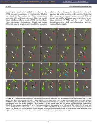 Alt et al. Adipose-derived regenerative cells
17
phospholipid, lysophosphatidylcholine (Lauber et al.,
2003). Increased concentration of lysophosphatidylcholine
was found in the medium in which hematopoietic
progenitor cells underwent apoptosis following growth
factor withdrawal (Fuchs et al., 2007). Our time-lapse
video microscopic investigations showed that human
ASCs that undergo apoptosis also stimulate the migration
of other cells to the apoptotic cell, and these other cells
can then take up the apoptotic bodies via pinocytosis (Fig.
20). However, it is currently unknown which ‘find me’
signals are used by ASCs that undergo apoptosis. In any
case, apoptosis of ASCs may be a key event in
immunosuppressive and anti-inflammatory activities
mediated by these cells.
FIGURE 20  Time-lapse video microscopy of human adipose-derived stem cells (ASCs) that were co-cultured with MDA-MB-231 cells
labeled with green fluorescent protein (GFP) (green signal; the red signal came from red Quantum dots that were exchanged between
the ASCs and the MDA-MB-231 cells (c.f. Fig. 18). The white arrow indicates an ASC that underwent apoptosis (named Cell A; the
disintegration of the cell body is marked in j by an asterisk). The red, yellow, green and blue arrows indicate four other cells (named
Cells B-E) that migrated towards Cell A during the three hours before disintegration of the cell body of Cell A (a-i). One of these cells
was an ASC (red arrows) whereas the other three cells were MDA-MB-231 cells. During the first 90 min after disintegration of the cell
body of Cell A, Cells B-E took up apoptotic bodies of Cell A by means of pinocytosis (indicated by larger arrows in the respective colors
in j,k,m,n). The time interval between the frames was 20 min each. The scale bar in (t) represents 50 µm.
Preprints (www.preprints.org) | NOT PEER-REVIEWED | Posted: 17 April 2019 doi:10.20944/preprints201904.0200.v1
 