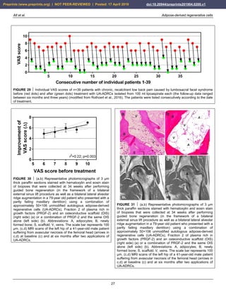 Alt et al. Adipose-derived regenerative cells
27
FIGURE 29  Individual VAS scores of n=39 patients with chronic, recalcitrant low back pain caused by lumbosacral facet syndrome
before (red dots) and after (green dots) treatment with UA-ADRCs isolated from 100 ml lipoaspirate each (the follow-up data ranged
between six months and three years) (modified from Rothoerl et al., 2016). The patients were listed consecutively according to the date
of treatment.
FIGURE 30  (a,b) Representative photomicrographs of 3 µm
thick paraffin sections stained with hematoxylin and eosin stain
of biopsies that were collected at 34 weeks after performing
guided bone regeneration (in the framework of a bilateral
external sinus lift procedure as well as a bilateral lateral alveolar
ridge augmentation in a 79-year old patient who presented with a
partly failing maxillary dentition) using a combination of
approximately 50×106 unmodified autologous adipose-derived
regenerative cells (UA-ADRCs), Fraction 2 of plasma rich in
growth factors (PRGF-2) and an osteoinductive scaffold (OIS)
(right side) (a) or a combination of PRGF-2 and the same OIS
alone (left side) (b). Abbreviations: A, adipocytes; B, newly
formed bone; S, scaffold; V, veins. The scale bar represents 100
µm. (c,d) MRI scans of the left hip of a 41-year-old male patient
suffering from avascular necrosis of the femoral head (arrows in
c,d) at baseline (c) and at six months after two applications of
UA-ADRCs.
FIGURE 31  (a,b) Representative photomicrographs of 3 µm
thick paraffin sections stained with hematoxylin and eosin stain
of biopsies that were collected at 34 weeks after performing
guided bone regeneration (in the framework of a bilateral
external sinus lift procedure as well as a bilateral lateral alveolar
ridge augmentation in a 79-year old patient who presented with a
partly failing maxillary dentition) using a combination of
approximately 50×106 unmodified autologous adipose-derived
regenerative cells (UA-ADRCs), Fraction 2 of plasma rich in
growth factors (PRGF-2) and an osteoinductive scaffold (OIS)
(right side) (a) or a combination of PRGF-2 and the same OIS
alone (left side) (b). Abbreviations: A, adipocytes; B, newly
formed bone; S, scaffold; V, veins. The scale bar represents 100
µm. (c,d) MRI scans of the left hip of a 41-year-old male patient
suffering from avascular necrosis of the femoral head (arrows in
c,d) at baseline (c) and at six months after two applications of
UA-ADRCs.
Preprints (www.preprints.org) | NOT PEER-REVIEWED | Posted: 17 April 2019 doi:10.20944/preprints201904.0200.v1
 