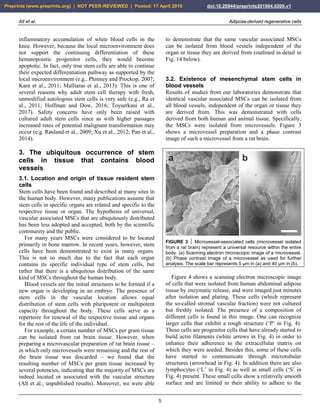 Alt et al. Adipose-derived regenerative cells
5
inflammatory accumulation of white blood cells in the
knee. However, because the local microenvironment does
not support the continuing differentiation of these
hematopoietic progenitor cells, they would become
apoptotic. In fact, only true stem cells are able to continue
their expected differentiation pathway as supported by the
local microenvironment (e.g., Phinney and Prockop, 2007;
Kara et al., 2011; Malliaras et al., 2013). This is one of
several reasons why adult stem cell therapy with fresh,
unmodified autologous stem cells is very safe (e.g., Ra et
al., 2011; Hoffman and Dow, 2016; Toyserkani et al.,
2017). Safety concerns have only been raised with
cultured adult stem cells since as with higher passages
increased rates of potential malignant transformation may
occur (e.g. Røsland et al., 2009; Xu et al., 2012; Pan et al.,
2014).
3. The ubiquitous occurrence of stem
cells in tissue that contains blood
vessels
3.1. Location and origin of tissue resident stem
cells
Stem cells have been found and described at many sites in
the human body. However, many publications assume that
stem cells in specific organs are related and specific to the
respective tissue or organ. The hypothesis of universal,
vascular associated MSCs that are ubiquitously distributed
has been less adopted and accepted, both by the scientific
community and the public.
For many years MSCs were considered to be located
primarily in bone marrow. In recent years, however, stem
cells have been demonstrated to exist in many organs.
This is not so much due to the fact that each organ
contains its specific individual type of stem cells, but
rather that there is a ubiquitous distribution of the same
kind of MSCs throughout the human body.
Blood vessels are the initial structures to be formed if a
new organ is developing in an embryo. The presence of
stem cells in the vascular location allows equal
distribution of stem cells with pluripotent or multipotent
capacity throughout the body. These cells serve as a
repertoire for renewal of the respective tissue and organs
for the rest of the life of the individual.
For example, a certain number of MSCs per gram tissue
can be isolated from rat brain tissue. However, when
preparing a microvascular preparation of rat brain tissue –
in which only microvessels were remaining and the rest of
the brain tissue was discarded – we found that the
resulting number of MSCs per gram tissue increased by
several potencies, indicating that the majority of MSCs are
indeed located or associated with the vascular structure
(Alt et al.; unpublished results). Moreover, we were able
to demonstrate that the same vascular associated MSCs
can be isolated from blood vessels independent of the
organ or tissue they are derived from (outlined in detail in
Fig. 14 below).
3.2. Existence of mesenchymal stem cells in
blood vessels
Results of studies from our laboratories demonstrate that
identical vascular associated MSCs can be isolated from
all blood vessels, independent of the organ or tissue they
are derived from. This was demonstrated with cells
derived from both human and animal tissue. Specifically,
the MSCs were isolated from microvessels. Figure 3
shows a microvessel preparation and a phase contrast
image of such a microvessel from a rat brain.
FIGURE 3  Microvessel-associated cells (microvessel isolated
from a rat brain) represent a universal resource within the entire
body. (a) Scanning electron microscopic image of a microvessel.
(b) Phase contrast image of a microvessel as used for further
analysis. The scale bar represents 5 µm in (a) and 40 µm in (b).
Figure 4 shows a scanning electron microscopic image
of cells that were isolated from human abdominal adipose
tissue by enzymatic release, and were imaged just minutes
after isolation and plating. These cells (which represent
the so-called stromal vascular fraction) were not cultured
but freshly isolated. The presence of a composition of
different cells is found in this image. One can recognize
larger cells that exhibit a rough structure (‘P’ in Fig. 4).
These cells are progenitor cells that have already started to
build actin filaments (white arrows in Fig. 4) in order to
enhance their adherence to the extracellular matrix on
which they were seeded. Besides this, some of these cells
have started to communicate through microtubular
structures (arrowhead in Fig. 4). In addition there are also
lymphocytes (‘L’ in Fig. 4) as well as small cells (‘S’ in
Fig. 4) present. These small cells show a relatively smooth
surface and are limited in their ability to adhere to the
Preprints (www.preprints.org) | NOT PEER-REVIEWED | Posted: 17 April 2019 doi:10.20944/preprints201904.0200.v1
 