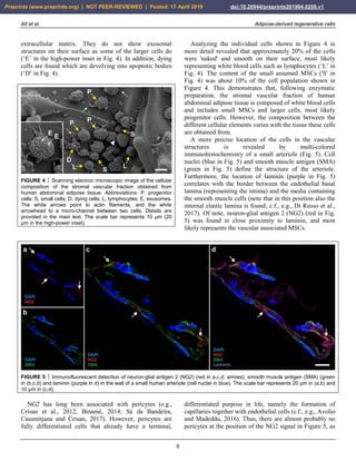 Alt et al. Adipose-derived regenerative cells
6
extracellular matrix. They do not show exosomal
structures on their surface as some of the larger cells do
(‘E’ in the high-power inset in Fig. 4). In addition, dying
cells are found which are devolving into apoptotic bodies
(‘D’ in Fig. 4).
FIGURE 4  Scanning electron microscopic image of the cellular
composition of the stromal vascular fraction obtained from
human abdominal adipose tissue. Abbreviations: P, progenitor
cells; S, small cells; D, dying cells; L, lymphocytes; E, exosomes.
The white arrows point to actin filaments, and the white
arrowhead to a micro-channel between two cells. Details are
provided in the main text. The scale bar represents 10 µm (20
µm in the high-power inset).
Analyzing the individual cells shown in Figure 4 in
more detail revealed that approximately 20% of the cells
were 'naked' and smooth on their surface, most likely
representing white blood cells such as lymphocytes (‘L’ in
Fig. 4). The content of the small assumed MSCs ('S' in
Fig. 4) was about 10% of the cell population shown in
Figure 4. This demonstrates that, following enzymatic
preparation, the stromal vascular fraction of human
abdominal adipose tissue is composed of white blood cells
and includes small MSCs and larger cells, most likely
progenitor cells. However, the composition between the
different cellular elements varies with the tissue these cells
are obtained from.
A more precise location of the cells in the vascular
structures is revealed by multi-colored
immunohistochemistry of a small arteriole (Fig. 5). Cell
nuclei (blue in Fig. 5) and smooth muscle antigen (SMA)
(green in Fig. 5) define the structure of the arteriole.
Furthermore, the location of laminin (purple in Fig. 5)
correlates with the border between the endothelial basal
lamina (representing the intima) and the media containing
the smooth muscle cells (note that in this position also the
internal elastic lamina is found; c.f., e.g., Di Russo et al.,
2017). Of note, neuron-glial antigen 2 (NG2) (red in Fig.
5) was found in close proximity to laminin, and most
likely represents the vascular associated MSCs.
FIGURE 5  Immunofluorescent detection of neuron-glial antigen 2 (NG2) (red in a,c,d; arrows), smooth muscle antigen (SMA) (green
in (b,c,d) and laminin (purple in d) in the wall of a small human arteriole (cell nuclei in blue). The scale bar represents 20 µm in (a,b) and
10 µm in (c,d).
NG2 has long been associated with pericytes (e.g.,
Crisan et al., 2012; Binamé, 2014; Sá da Bandeira,
Casamitjana and Crisan, 2017). However, pericytes are
fully differentiated cells that already have a terminal,
differentiated purpose in life, namely the formation of
capillaries together with endothelial cells (c.f., e.g., Avolio
and Madeddu, 2016). Thus, there are almost probably no
pericytes at the position of the NG2 signal in Figure 5, as
Preprints (www.preprints.org) | NOT PEER-REVIEWED | Posted: 17 April 2019 doi:10.20944/preprints201904.0200.v1
 
