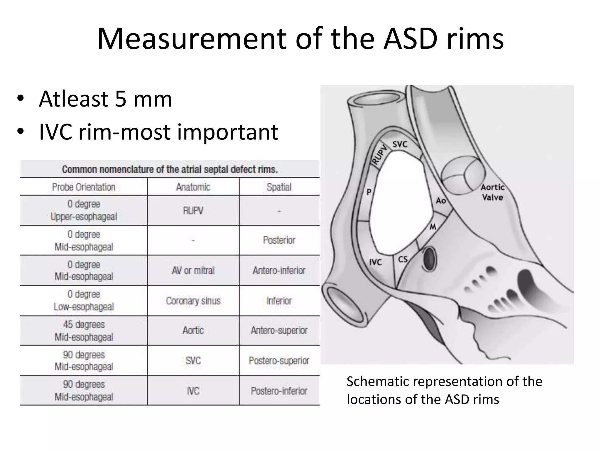 Measurement of the ASD rims
• Atleast 5 mm
• IVC rim-most important
Schematic representation of the
locations of the ASD rims
 