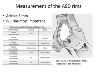 Peripheric Rim Location ECHO ASSESSMENT OF ASD FOR DEVICE CLOSURE | PPTX