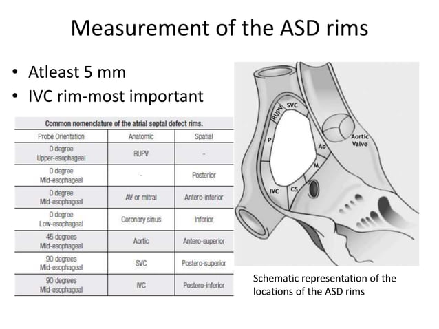 ECHO ASSESSMENT OF ASD FOR DEVICE CLOSURE | PPTX | 3-D Graphics ...