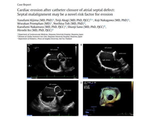 ECHO ASSESSMENT OF ASD FOR DEVICE CLOSURE | PPTX