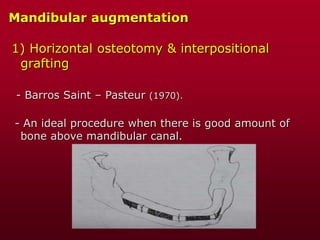 Mandibular augmentation
1) Horizontal osteotomy & interpositional
grafting
- Barros Saint – Pasteur (1970).
- An ideal procedure when there is good amount of
bone above mandibular canal.
 