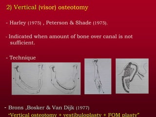 2) Vertical (visor) osteotomy
- Harley (1975) , Peterson & Shade (1975).
- Indicated when amount of bone over canal is not
sufficient.
- Technique
- Brons ,Bosker & Van Dijk (1977)
“Vertical osteotomy + vestibuloplasty + FOM plasty”
 