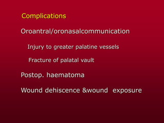 Complications
Oroantral/oronasalcommunication
Injury to greater palatine vessels
Fracture of palatal vault
Postop. haematoma
Wound dehiscence &wound exposure
 