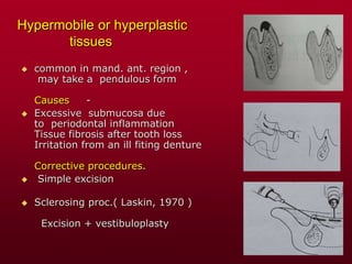 Hypermobile or hyperplastic
tissues
 common in mand. ant. region ,
may take a pendulous form
Causes -
 Excessive submucosa due
to periodontal inflammation
Tissue fibrosis after tooth loss
Irritation from an ill fiting denture
Corrective procedures.
 Simple excision
 Sclerosing proc.( Laskin, 1970 )
Excision + vestibuloplasty
 