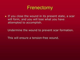 Frenectomy
 If you close the wound in its present state, a scar
will form, and you will lose what you have
attempted to accomplish.
Undermine the wound to prevent scar formation.
This will ensure a tension-free wound.
 