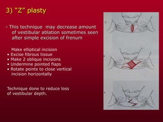 3) “Z” plasty
- This technique may decrease amount
of vestibular ablation sometimes seen
after simple excision of frenum
Make elliptical incision
• Excise fibrous tissue
• Make 2 oblique incisions
• Undermine pointed flaps
• Rotate points to close vertical
incision horizontally
Technique done to reduce loss
of vestibular depth.
 