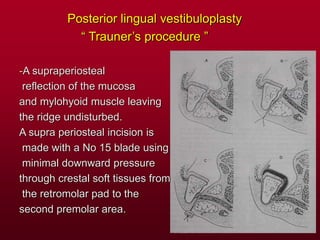 Posterior lingual vestibuloplasty
“ Trauner’s procedure ”
-A supraperiosteal
reflection of the mucosa
and mylohyoid muscle leaving
the ridge undisturbed.
A supra periosteal incision is
made with a No 15 blade using
minimal downward pressure
through crestal soft tissues from
the retromolar pad to the
second premolar area.
 