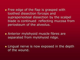  Free edge of the flap is grasped with
toothed dissection forceps and
supraperiosteal dissection by the scalpel
blade is continued reflecting mucosa from
periosteum of the alveolus.
 Anterior mylohyoid muscle fibres are
separated from mylohyoid ridge.
 Lingual nerve is now exposed in the depth
of the wound.
 