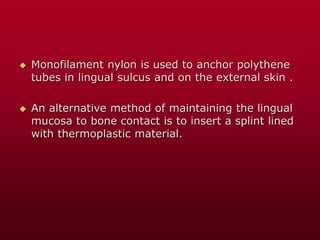  Monofilament nylon is used to anchor polythene
tubes in lingual sulcus and on the external skin .
 An alternative method of maintaining the lingual
mucosa to bone contact is to insert a splint lined
with thermoplastic material.
 