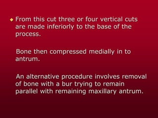  From this cut three or four vertical cuts
are made inferiorly to the base of the
process.
Bone then compressed medially in to
antrum.
An alternative procedure involves removal
of bone with a bur trying to remain
parallel with remaining maxillary antrum.
 