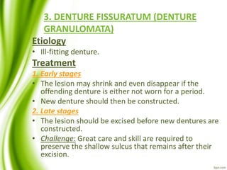 3. DENTURE FISSURATUM (DENTURE
GRANULOMATA)
Etiology
• Ill-fitting denture.
Treatment
1. Early stages
• The lesion may shrink and even disappear if the
offending denture is either not worn for a period.
• New denture should then be constructed.
2. Late stages
• The lesion should be excised before new dentures are
constructed.
• Challenge: Great care and skill are required to
preserve the shallow sulcus that remains after their
excision.
 