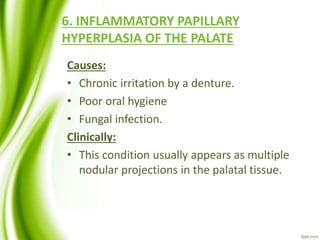 6. INFLAMMATORY PAPILLARY
HYPERPLASIA OF THE PALATE
Causes:
• Chronic irritation by a denture.
• Poor oral hygiene
• Fungal infection.
Clinically:
• This condition usually appears as multiple
nodular projections in the palatal tissue.
 