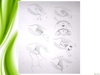 Slide Title
• Make Effective Presentations
• Using Awesome Backgrounds
• Engage your Audience
• Capture Audience Attention
 