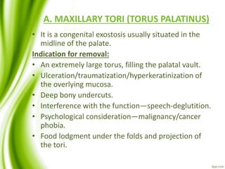 A. MAXILLARY TORI (TORUS PALATINUS)
• It is a congenital exostosis usually situated in the
midline of the palate.
Indication for removal:
• An extremely large torus, filling the palatal vault.
• Ulceration/traumatization/hyperkeratinization of
the overlying mucosa.
• Deep bony undercuts.
• Interference with the function—speech-deglutition.
• Psychological consideration—malignancy/cancer
phobia.
• Food lodgment under the folds and projection of
the tori.
 