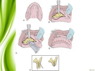 Slide Title
• Make Effective Presentations
• Using Awesome Backgrounds
• Engage your Audience
• Capture Audience Attention
 